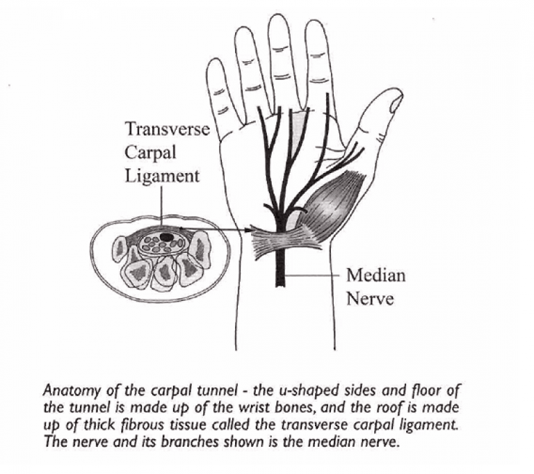 Sindrom Lorong Karpal Hand Surgery Associates